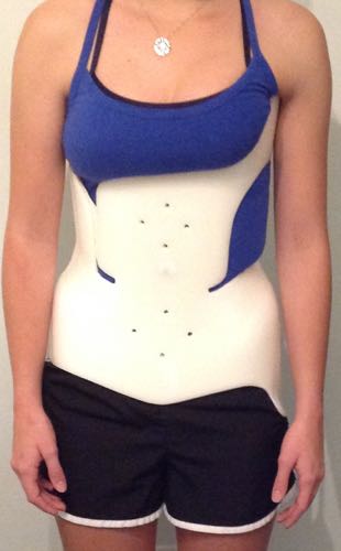 All Scoliosis Braces Are Not The Same. You Be The Judge - Advance  Physical Therapy