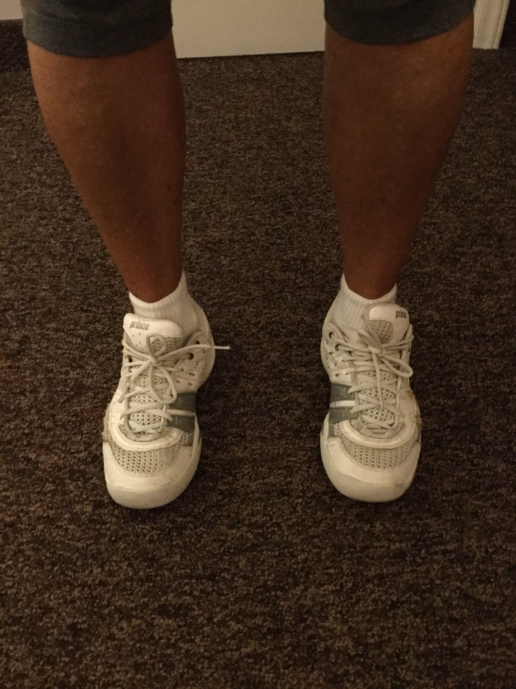 High arches in shoes with inserts that cause the feet to "roll out". This can result in knee pain and compensation elsewhere in the body.